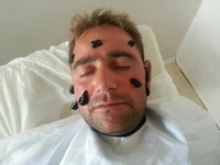 Sinüzit Sülük Tedavisi Sinüzit Sülük Tedavisi