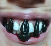 Sülüğün Faydaları Nelerdir? Sülüğün Faydaları Nelerdir?