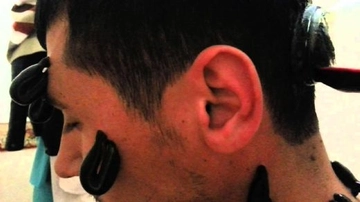 Kafaya Sülük Koydurmak